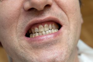 can a toothache cause ear pain effect